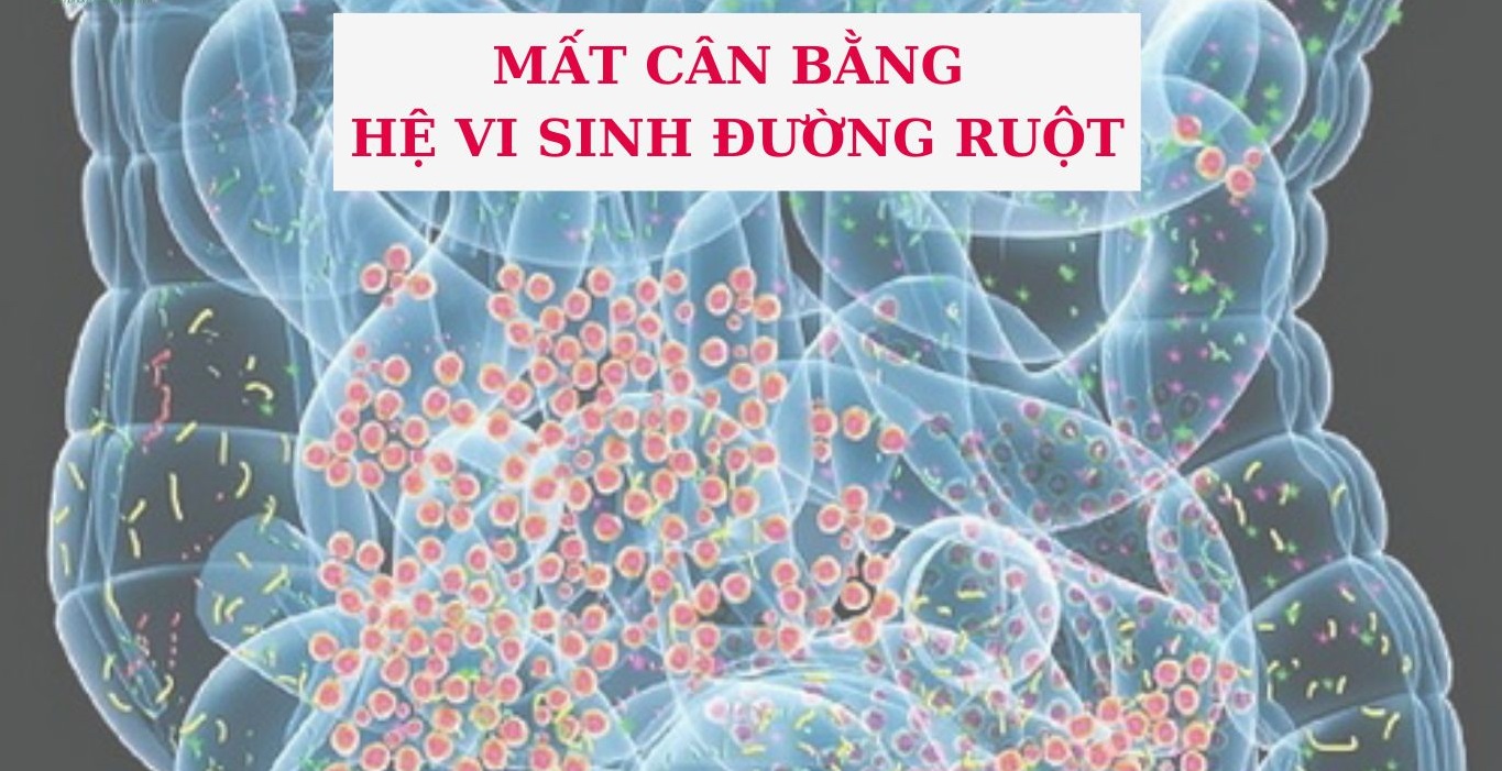 mat-can-bang-he-vi-sinh-duong-ruot-1